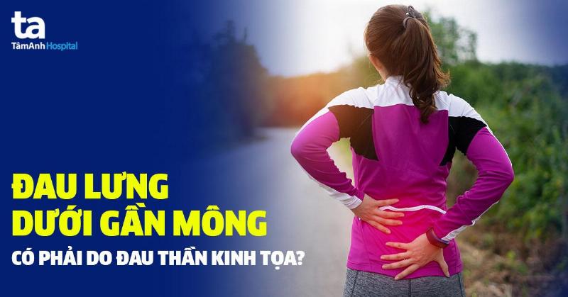 Các loại mông lung
