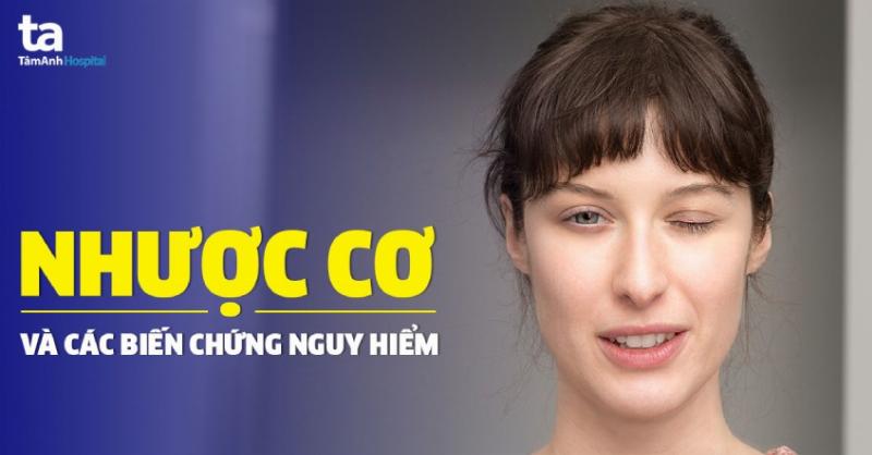 Cách sử dụng phương pháp khắc phục nhu nhược