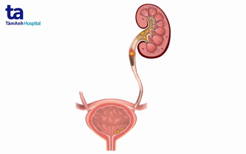 Chẩn đoán cận lâm sàng