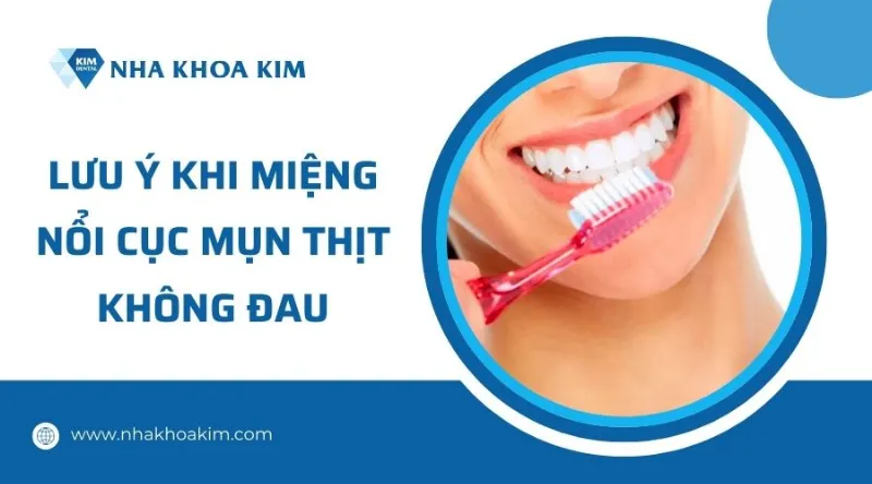 Lưu ý khi nổi cục trong miệng